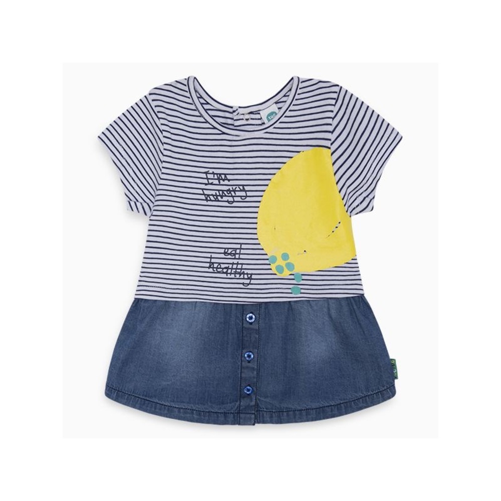 Blue and Yellow Casual Dress with Striped Top